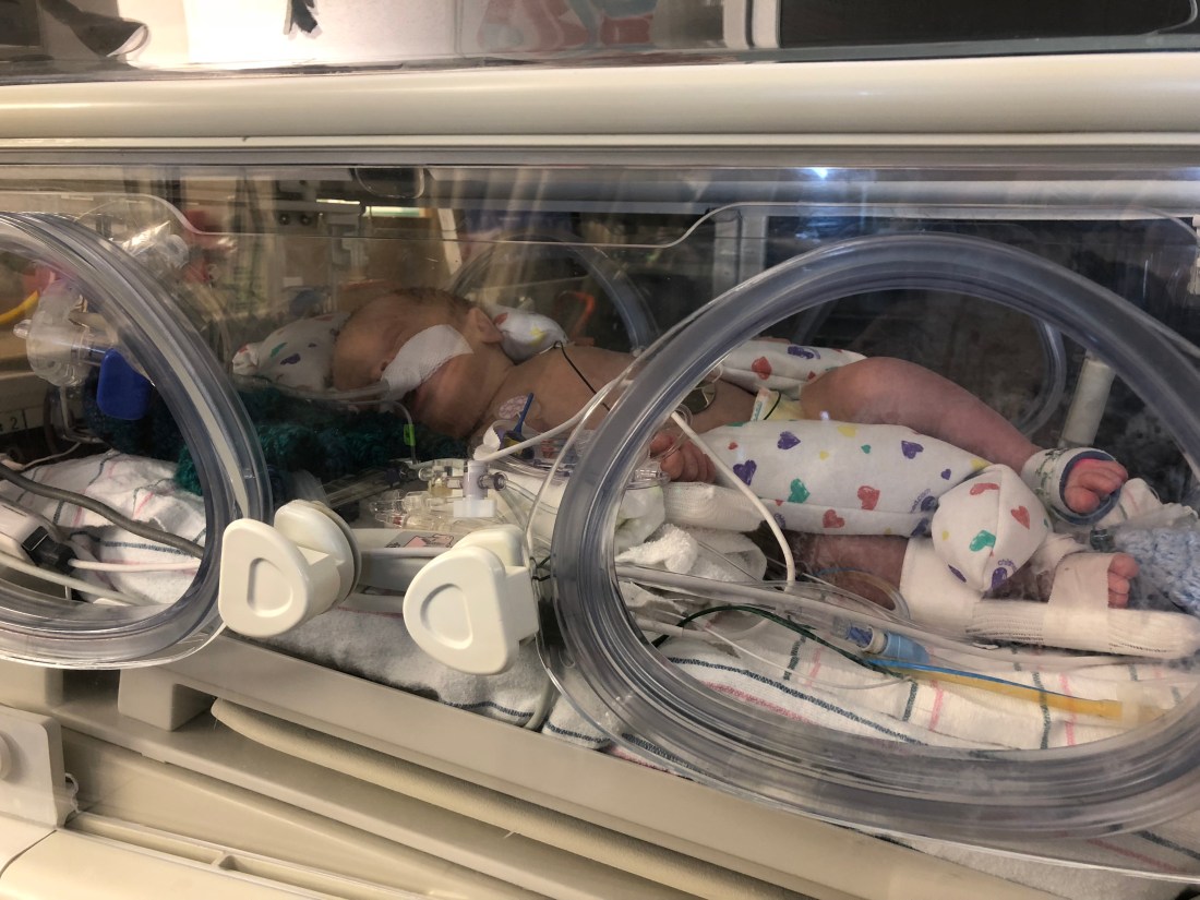 3CB9CDC9-4EFE-450F-9881-8538A9F5B0F8